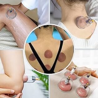 Model Art Spa Tlalnepantla (A Un Costado De Mundo E) Revisión Y Opiniones 10 Cama De Masajes Y Acupuntura Coreana
