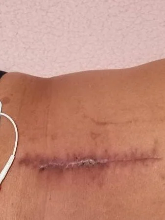 Mejores Masajes En Juárez Cerca De Mi 45 Masajes En Cuauhtémoc