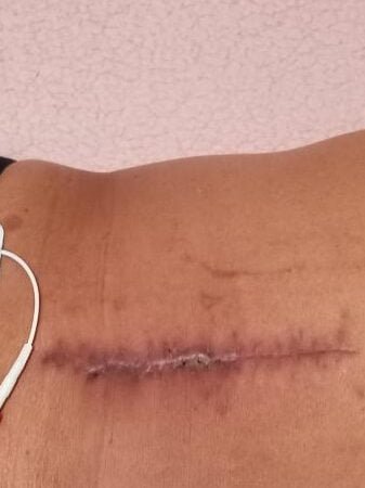 Mejores Masajes En Tlalpan Cerca De Mi 11 Masajes En Cuauhtémoc