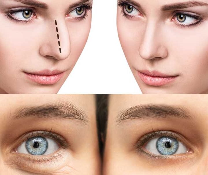 Venus Spa Revisión Y Opiniones 9 Rostros Estética